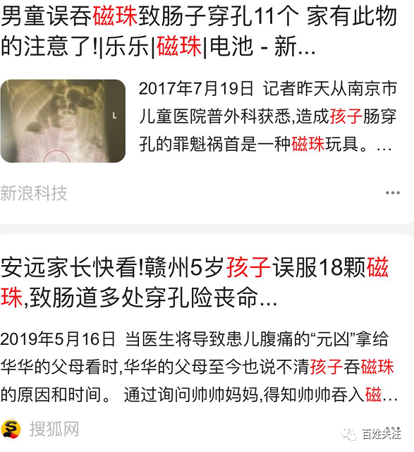 整整吞了123颗!这东西有强磁性,贵州一男童误吞后紧急送医,医生都吓坏了